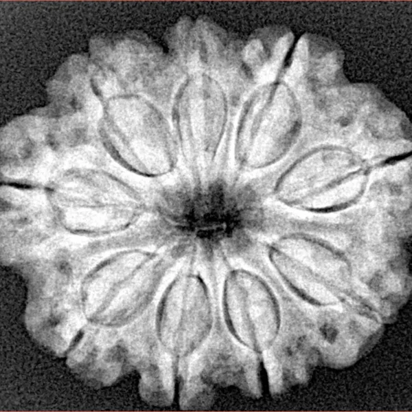 9 Mukhi Rudraksha 27.2mm 5.37gm - Xray
