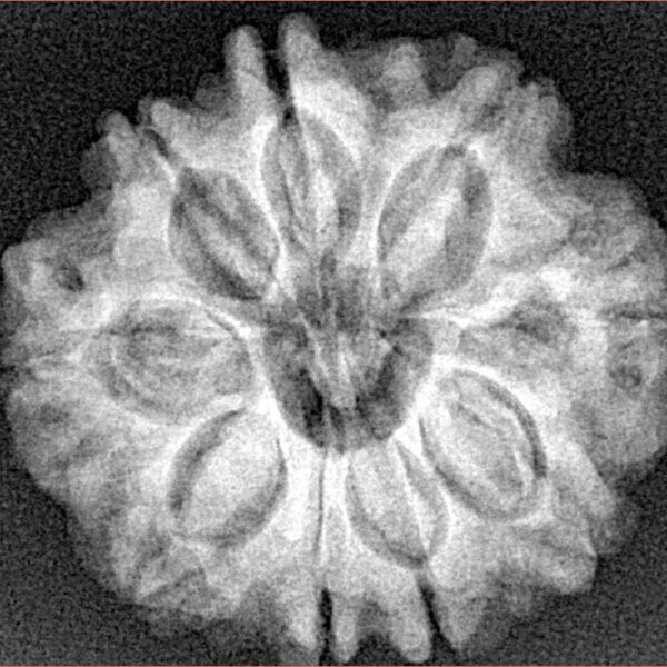 9 Mukhi Rudraksha 25mm 4.94gm - Xray