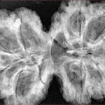 9 MK Gaurishankar 38.3mm 8.2gm - Xray