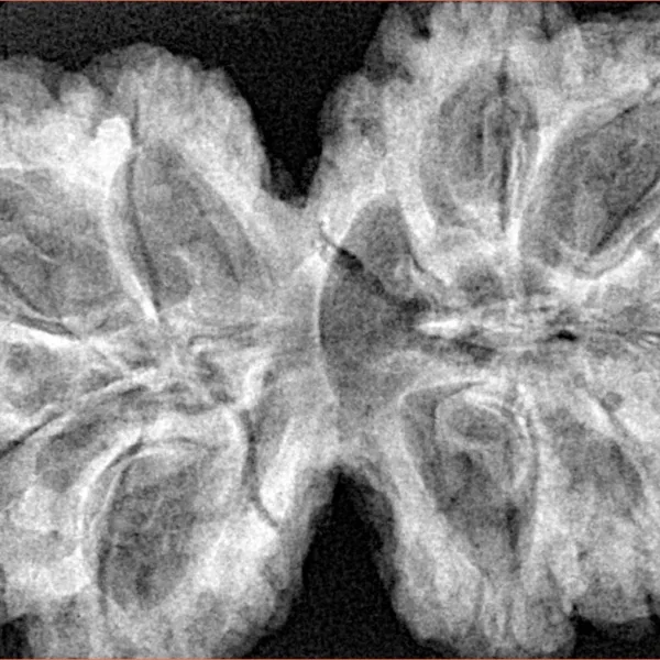 9 MK Gaurishankar 38.3mm 8.2gm - Xray