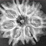 9 Mukhi Rudraksha 25.2mm 3.16gm - Xray