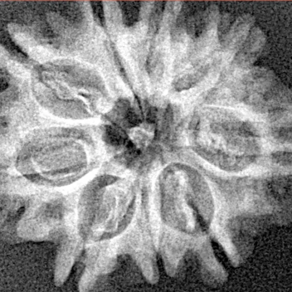 9 Mukhi Rudraksha 25.2mm 3.16gm - Xray