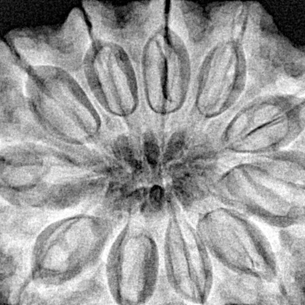 11 Mukhi Rudraksha 34.5mm 9.39gm - Xray