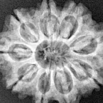 9 Mukhi Rudraksha 20mm 5gm - Xray