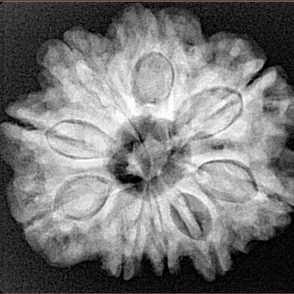 9 Mukhi Rudraksha 26.5mm 5.69gm - Xray