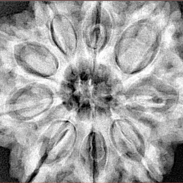 9 Mukhi Rudraksha 32mm 9.35gm - Xray