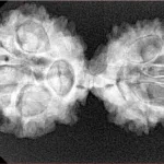11 MK Gaurishankar 35.9mm 5.58gm - Xray