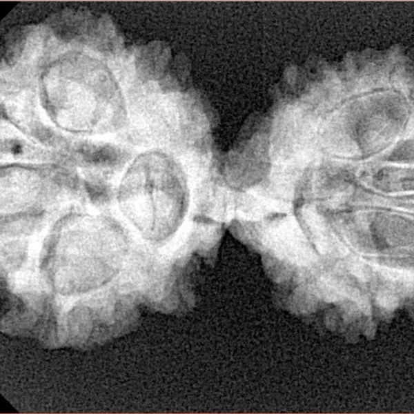 11 MK Gaurishankar 35.9mm 5.58gm - Xray