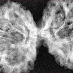 9 MK Gaurishankar 44.7mm 9.57gm - Xray