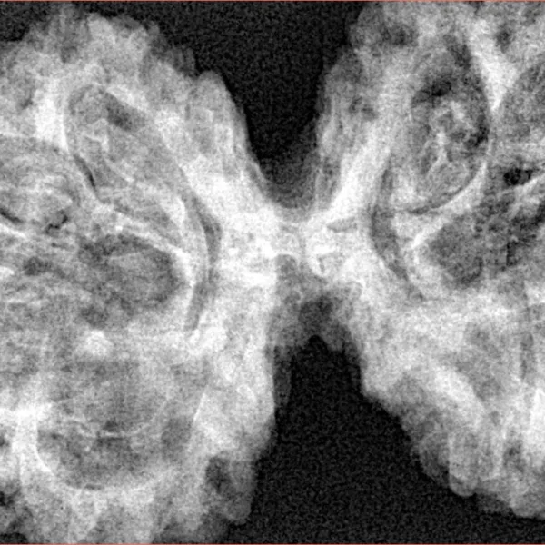 9 MK Gaurishankar 44.7mm 9.57gm - Xray