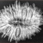 17 Mukhi Rudraksha 29.1mm 4.9gm - Xray