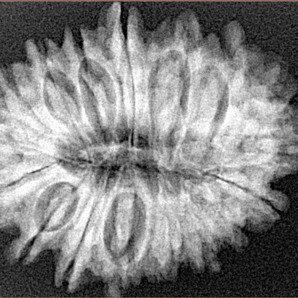 17 Mukhi Rudraksha 29.1mm 4.9gm - Xray