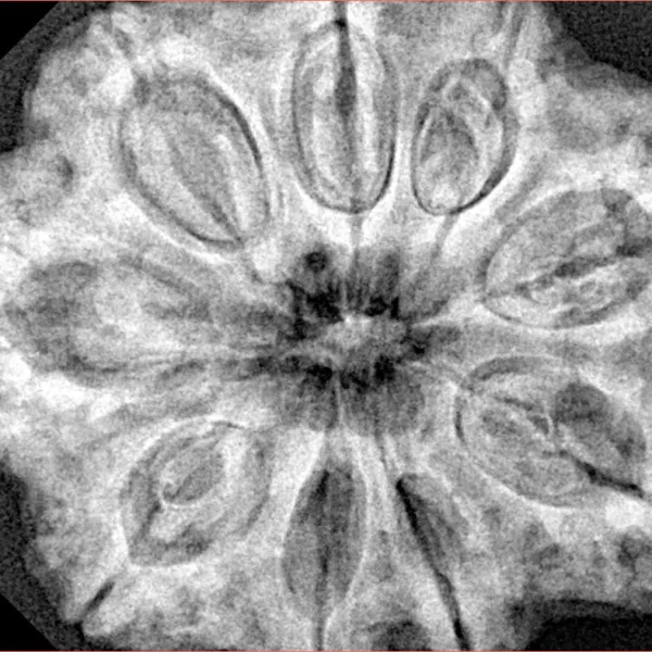 9 Mukhi Rudraksha 32.4mm 8.44gm - Xray