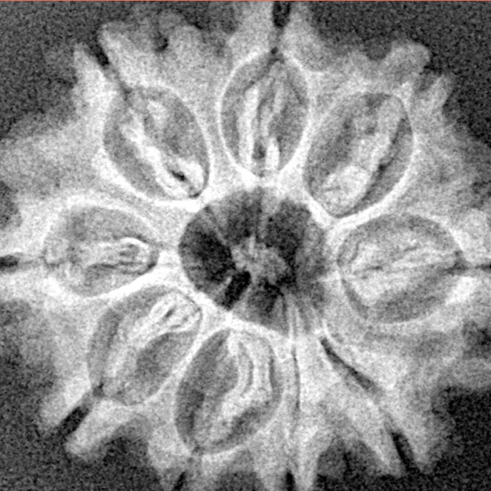 9 Mukhi Rudraksha 25.1mm 3.72gm - Xray