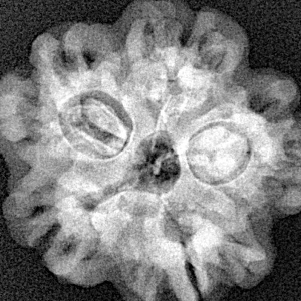 1MK(Underdeveloped) 24.2mm 4.29gm - Xray