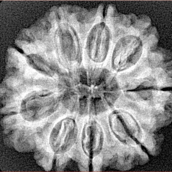 9 Mukhi Rudraksha 27.2mm 5gm - Xray
