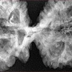 11 MK Gaurishankar 48mm 10.65gm - Xray