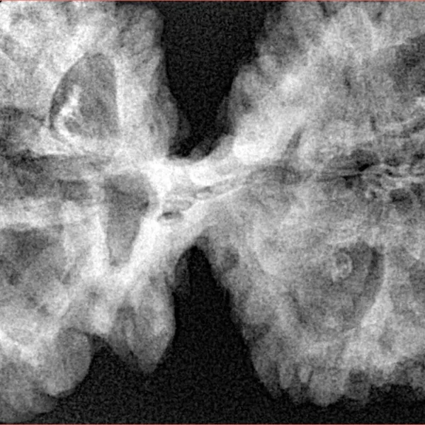 11 MK Gaurishankar 48mm 10.65gm - Xray