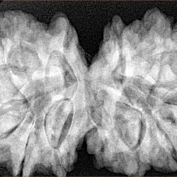 12 MK Gaurishankar 38.6mm 9.7gm - Xray