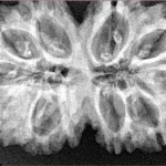 11 MK Gaurishankar 36.4mm 7.51gm - Xray