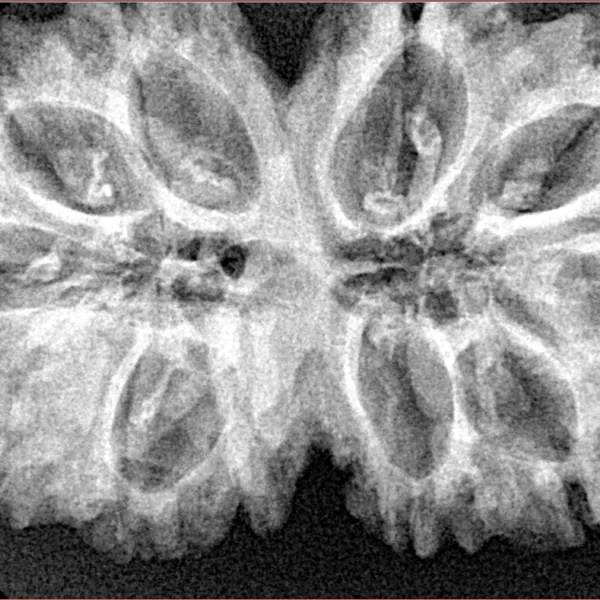 11 MK Gaurishankar 36.4mm 7.51gm - Xray