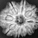 9 Mukhi Rudraksha 25.2mm 4.78gm - Xray