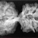 11 MK Gaurishankar 38.7mm 7.83gm - Xray
