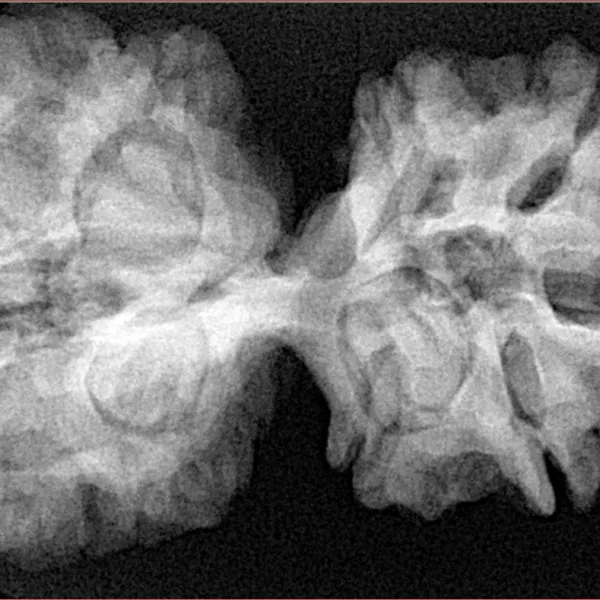 11 MK Gaurishankar 38.7mm 7.83gm - Xray