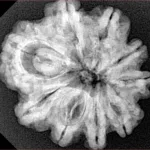 9 Mukhi Rudraksha 26.2mm 5gm - Xray