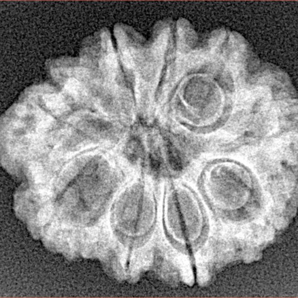 9 Mukhi Rudraksha 25.1mm 3.32gm - Xray