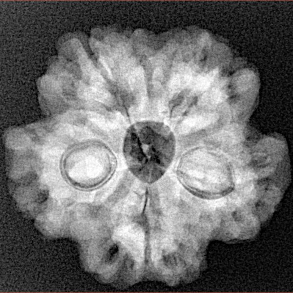 1MK(Underdeveloped) 24.4mm 4.48gm - Xray
