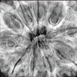 10 Mukhi Rudraksha 36.8mm 10.37gm - Xray