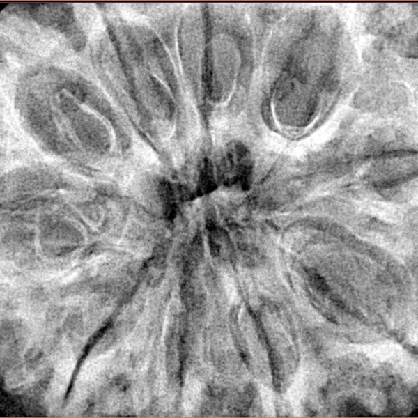 10 Mukhi Rudraksha 36.8mm 10.37gm - Xray