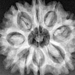 9 Mukhi Rudraksha 27.9mm 4.9gm - Xray