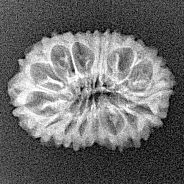 16 Mukhi Rudraksha 21.1mm 1.62gm - Xray