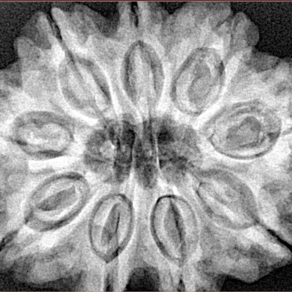 9 Mukhi Rudraksha 31.8mm 8.12gm - Xray
