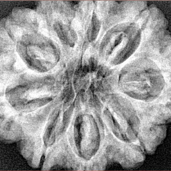 9 Mukhi Rudraksha 30.9mm 7gm - Xray