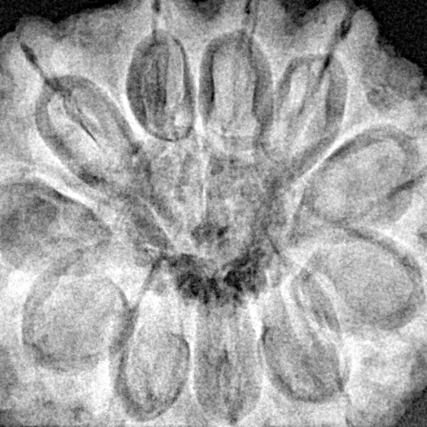 11 Mukhi Rudraksha 30.7mm 7.88gm - Xray