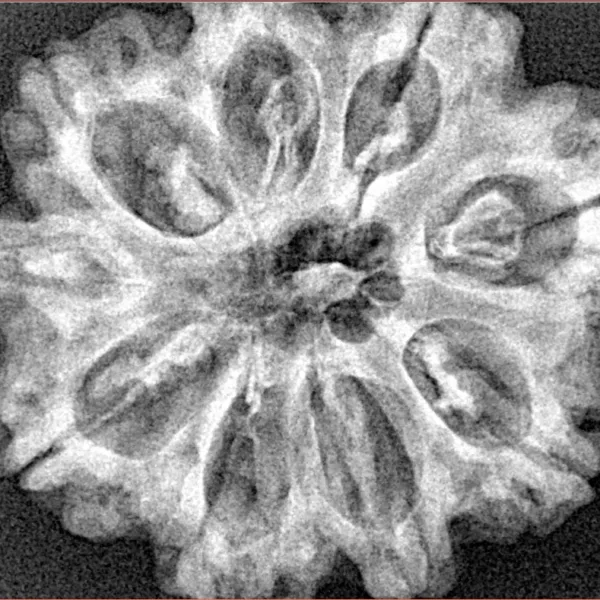 9 Mukhi Rudraksha 29.8mm 5.72gm - Xray