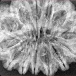 14 Mukhi Rudraksha 32.7mm 4.8gm - Xray