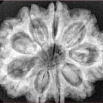 9 Mukhi Rudraksha 31.7mm 6.9gm - Xray