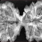 10 Mk Gaurishankar 39.8mm 8.83gm - Xray