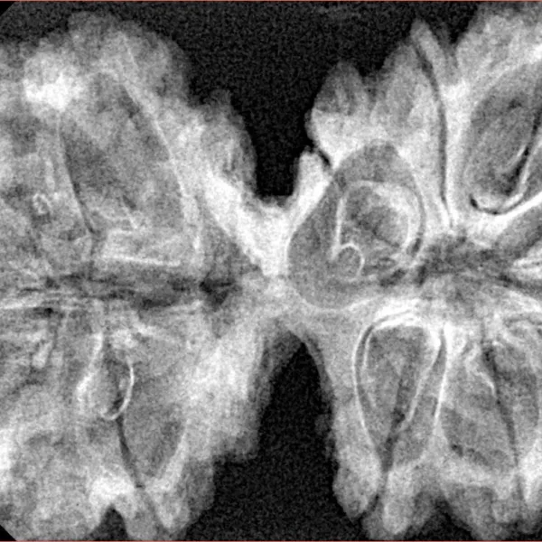 10 Mk Gaurishankar 39.8mm 8.83gm - Xray