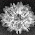 9 Mukhi Rudraksha 24.7mm 3.51gm - Xray