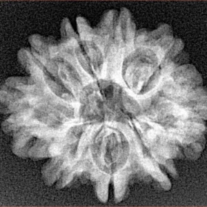9 Mukhi Rudraksha 24.7mm 3.51gm - Xray