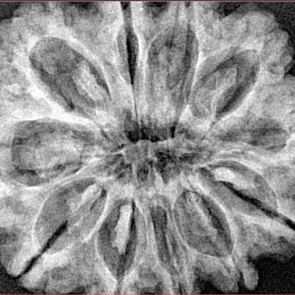 11 Mukhi Rudraksha 31.6mm 7gm - Xray