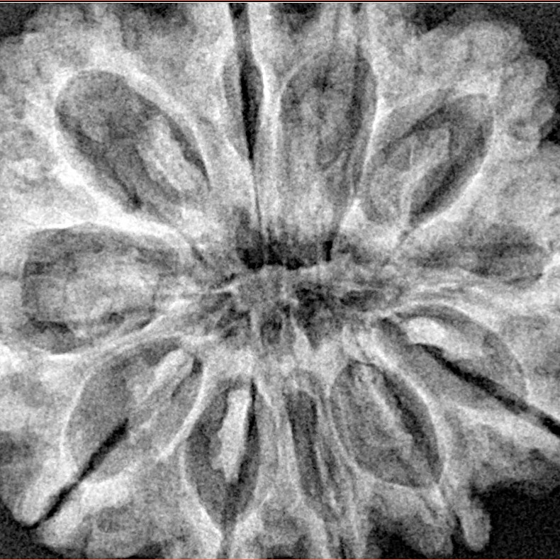 11 Mukhi Rudraksha 31.6mm 7gm - Xray