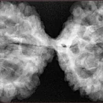 10 Mk Gaurishankar 49.2mm 10.79gm - Xray