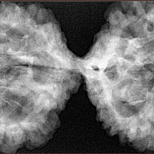 10 Mk Gaurishankar 49.2mm 10.79gm - Xray
