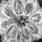 9 Mukhi Rudraksha 33.5mm 9.42gm - Xray